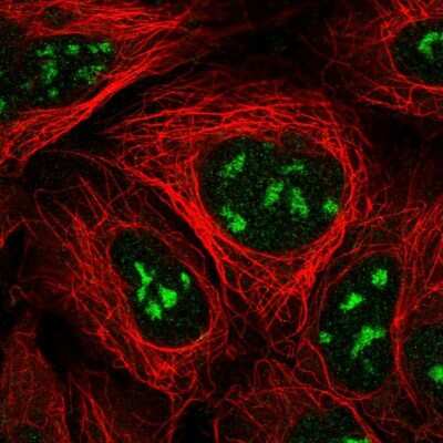 Immunocytochemistry/ Immunofluorescence NVL Antibody - BSA Free