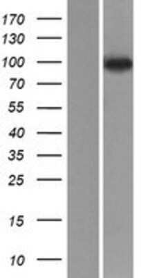 Western Blot: NVL Overexpression Lysate (Adult Normal) [NBP2-08104] Left-Empty vector transfected control cell lysate (HEK293 cell lysate); Right -Over-expression Lysate for NVL.