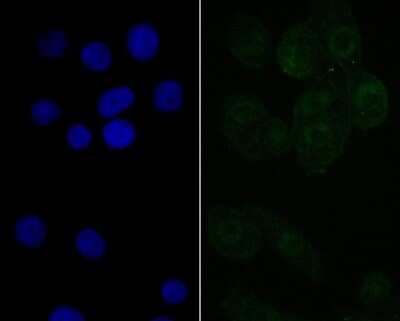 Immunocytochemistry/Immunofluorescence: NXF1 Antibody (JE40-63) [NBP2-76856] - ICC staining NXF1 in LOVO cells (green). The nuclear counter stain is DAPI (blue). Cells were fixed in paraformaldehyde, permeabilised with 0.25% Triton X100/PBS.