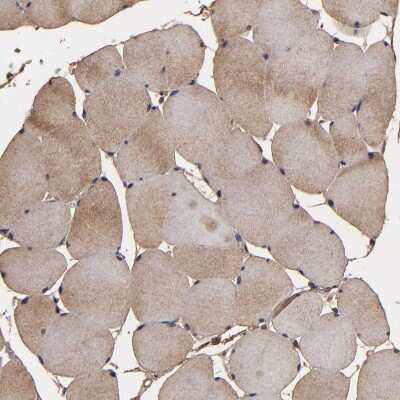 Immunohistochemistry-Paraffin: NXF2 Antibody [NBP1-85809] - Staining of human skeletal muscle shows moderate cytoplasmic positivity in myocytes.