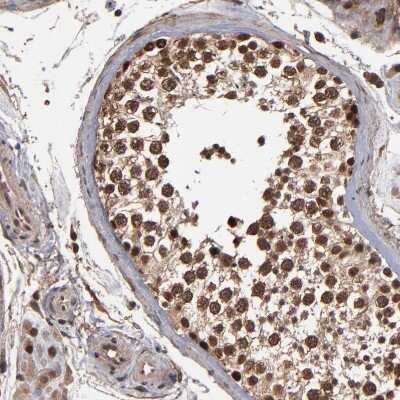 Immunohistochemistry-Paraffin: NXF2 Antibody [NBP1-85809] - Staining of human testis shows strong nuclear positivity in cells in seminiferous ducts.