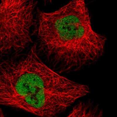 Immunocytochemistry/Immunofluorescence: NXF3 Antibody [NBP2-38557] - Immunofluorescent staining of human cell line U-2 OS shows localization to nucleoplasm.