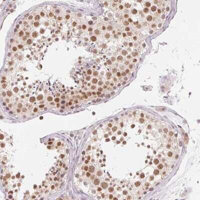 Immunohistochemistry: NXF3 Antibody [NBP2-38557] - Staining of human testis shows strong nuclear positivity in cells in seminiferous ducts.