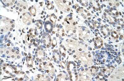 Immunohistochemistry-Paraffin: NXF3 Antibody [NBP1-57276] - Human kidney Tissue, antibody concentration 4-8ug/ml. Cells with positive label: renal corpuscle cells (indicated with arrows) 400X magnification.