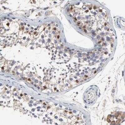 Immunohistochemistry-Paraffin: NXF3 Antibody [NBP1-89471] - Staining of human testis shows strong nuclear and cytoplasmic positivity in cells in seminiferus ducts, Leydig cells expressed moderate cytoplasmic staining.