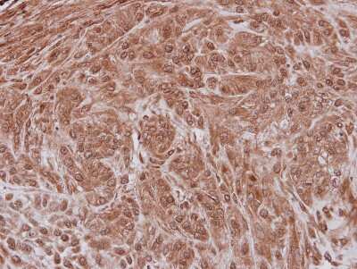 Immunohistochemistry-Paraffin: NXF3 Antibody [NBP2-19614] - Immunohistochemical analysis of paraffin-embedded A549 xenograft, using antibody at 1:100 dilution.
