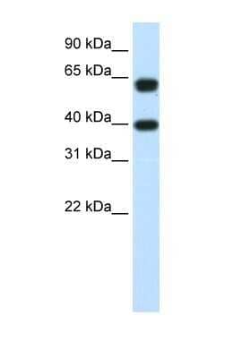 Western Blot: NXF3 Antibody [NBP1-57276] - RPMI 8226 cell lysate, Antibody Titration: 1.25ug/ml