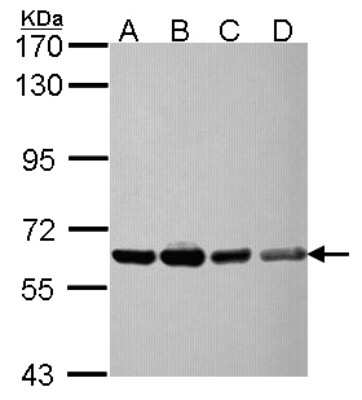 Western Blot: NXF3 Antibody [NBP2-19614] - Sample (30 ug of whole cell lysate) A: NT2D1 B: IMR32 C: U87-MG D: MCF-7 7. 5% SDS PAGE gel, diluted at 1:10000.
