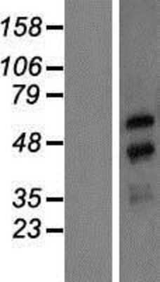 Western Blot NXF3 Overexpression Lysate
