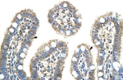 Immunohistochemistry-Paraffin NXF5 Antibody