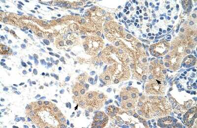 Immunohistochemistry-Paraffin NXF5 Antibody