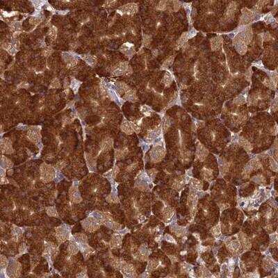 Immunohistochemistry-Paraffin NXNL2 Antibody