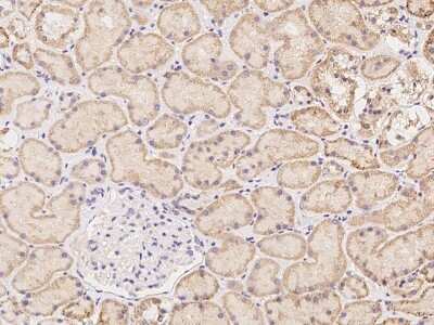 Immunohistochemistry-Paraffin NXNL2 Antibody - BSA Free