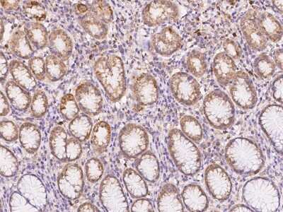 Immunohistochemistry-Paraffin: NXNL2 Antibody [NBP3-06016] - Immunochemical staining of human NXNL2 in human stomach with rabbit polyclonal antibody at 1:500 dilution, formalin-fixed paraffin embedded sections.