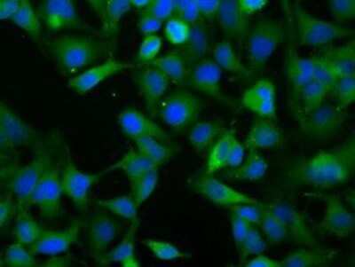 Immunocytochemistry/Immunofluorescence: NXNL2 Antibody (OTI2B11) - Azide and BSA Free [NBP2-73134] - Staining of HeLa cells using anti-NXNL2 mouse monoclonal antibody.