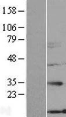 Western Blot: NXNL2 Overexpression Lysate (Adult Normal) [NBL1-13892] Left-Empty vector transfected control cell lysate (HEK293 cell lysate); Right -Over-expression Lysate for NXNL2.