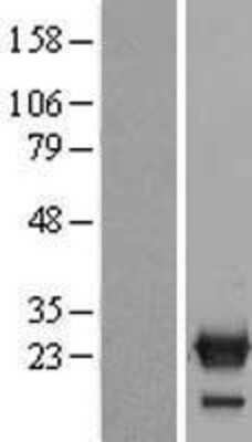 Western Blot NXT2 Overexpression Lysate