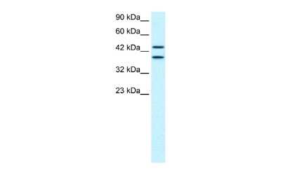 Western Blot: NY-REN-50 antigen Antibody [NBP2-83299] - WB Suggested Anti-C14ORF131 Antibody Titration: 0.3-0.5ug/ml. Positive Control: HepG2 cell lysateZNF839 is supported by BioGPS gene expression data to be expressed in HepG2