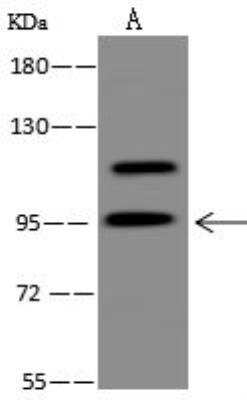 Western Blot: NY-REN-50 antigen Antibody [NBP3-12662] - Lane A: U-251MG Whole Cell LysateLysates/proteins at 30 ug per lane.SecondaryGoat Anti-Rabbit IgG (H+L)/HRP at 1/10000 dilution.Developed using the ECL technique.Performed under reducing conditions.Predicted band size:87 kDaObserved band size:95 kDa(We are unsure as to the identity of these extra bands.)
