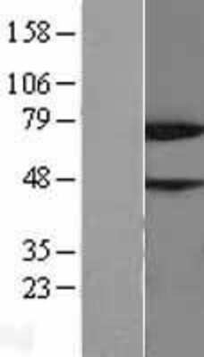 Western Blot: NYREN18 Overexpression Lysate (Adult Normal) [NBL1-13845] Left-Empty vector transfected control cell lysate (HEK293 cell lysate); Right -Over-expression Lysate for NYREN18.