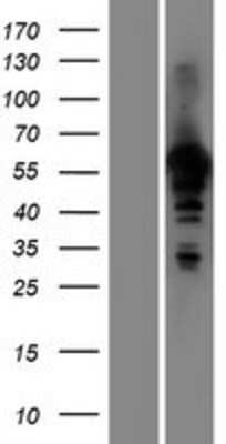 Western Blot: HAUS8 Overexpression Lysate (Native) [NBP2-05878] - Left-Empty vector transfected control cell lysate (HEK293 cell lysate); Right -Over-expression Lysate for NYS48.