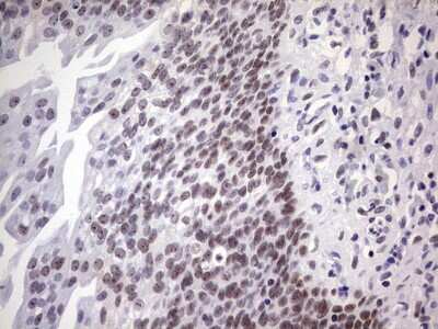 Immunohistochemistry: Nab2 Antibody (5D7) [NBP2-46080] - Analysis of Human bladder tissue. (Heat-induced epitope retrieval by 1 mM EDTA in 10mM Tris, pH8.5, 120C for 3min)