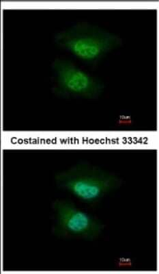 Immunocytochemistry/Immunofluorescence: Nab2 Antibody [NBP2-19462] - Analysis of paraformaldehyde-fixed HeLa, using antibody at 1:500 dilution.