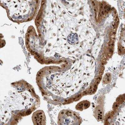 Immunohistochemistry-Paraffin: Nab2 Antibody [NBP1-82804] - Staining of human placenta shows distinct nuclear and cytoplasmic positivity in syncytiotrophoblasts.