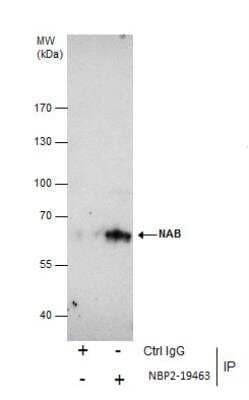 Immunoprecipitation: Nab2 Antibody [NBP2-19463] - Immunoprecipitation of NAB2 protein from Jurkat whole cell extracts using 5 ug of NAB2 antibody [N3C2], Internal.  Western blot analysis was performed using NAB2 antibody [N3C2], Internal. EasyBlot anti-Rabbit IgG was used as a secondary reagent.