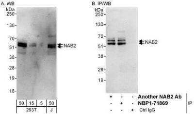 Western Blot: Nab2 Antibody [NBP1-71869] - Whole cell lysate from 293T (5, 15 and 50 mcg for WB; 1 mg for IP, 20% of IP loaded) and Jurkat (J; 50 mcg) cells.  Affinity purified rabbit anti-NAB2 antibody used for WB at 0.1 mcg/ml (A) and 1 mcg/ml (B) and used for IP at 6 mcg/mg lysate.  NAB2 was also immunoprecipitated by another rabbit anti-NAB2 antibody which recognizes an upstream epitope.