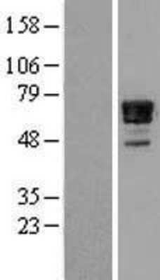 Western Blot: Nab2 Overexpression Lysate (Adult Normal) [NBL1-13453] Left-Empty vector transfected control cell lysate (HEK293 cell lysate); Right -Over-expression Lysate for Nab2.