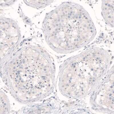 Immunohistochemistry-Paraffin: Nanog Antibody (CL5803) [NBP2-61428] - Staining of human testis shows absence of positivity as expected (negative control).
