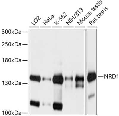 Western Blot: Nardilysin Antibody [NBP2-93058] - Analysis of extracts of various cell lines, using Nardilysin at 1:1000 dilution.Secondary antibody: HRP Goat Anti-Rabbit IgG (H+L) at 1:10000 dilution.Lysates/proteins: 25ug per lane.Blocking buffer: 3% nonfat dry milk in TBST.Detection: ECL Basic Kit .Exposure time: 1s.