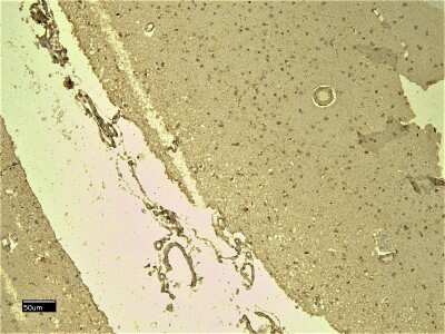 Immunohistochemistry-Paraffin: Nav1.5 Antibody [NB600-804] - Staining (8ug/ml) of paraffin embedded Human Cortex. Heat induced antigen retrieval with citrate buffer pH 6, HRP-Staining.