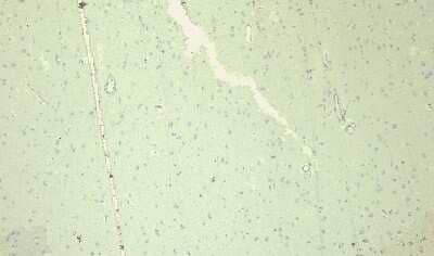 Immunohistochemistry-Paraffin: Nav1.5 Antibody [NB600-804] - Negative Control showing staining of paraffin embedded Human Cortex, with no primary antibody.