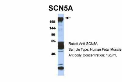 Western Blot: Nav1.5 Antibody [NBP2-86725] - Host: Rabbit. Target Name: SCN5A. Sample Type: Human Fetal Muscle. Antibody Dilution: 1.0ug/ml