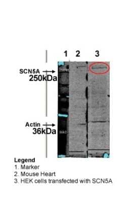 Western Blot: Nav1.5 Antibody [NBP2-86726] - WB Suggested Anti-SCN5A Antibody Titration: HEK cel lysate; HEK cel with HuNav1.5 transfected lysate; Mouse Heart lysate80 ug protein on gelQC Antibodies 1:100 in PBS/Tweensecondary antibodies 1:10.000 ( IRDYE 800 CWGoat anti Rabbit IgG)