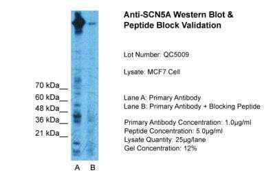 Western Blot: Nav1.5 Antibody [NBP2-86727] - Host: Rabbit. Target Name: SCN5A. Sample Type: MCF7 Whole Cell. Lane A: Primary Antibody. Lane B: Primary Antibody + Blocking Peptide. Primary Antibody Concentration: 1ug/ml. Peptide Concentration: 5ug/ml. Lysate Quantity: 25ug/lane/Lane. Gel Concentration: 0.12