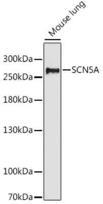 Western Blot: Nav1.5 Antibody [NBP2-94760] - Analysis of extracts of mouse lung, using Nav1.5 at 1:1000 dilution. Secondary antibody: HRP Goat Anti-Rabbit IgG (H+L) at 1:10000 dilution.Lysates/proteins: 25ug per lane.Blocking buffer: 3% nonfat dry milk in TBST.Detection: ECL Basic Kit .Exposure time: 180s.