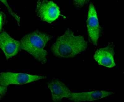 Immunocytochemistry/Immunofluorescence: Nav1.7 Antibody [NBP2-75581] - Staining NaV1.7 in A549 cells (green). The nuclear counter stain is DAPI (blue). Cells were fixed in paraformaldehyde, permeabilised with 0.25% Triton X100/PBS.