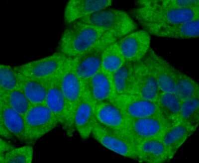 Immunocytochemistry/Immunofluorescence: Nav1.7 Antibody [NBP2-75581] - Staining NaV1.7 in Hela cells (green). The nuclear counter stain is DAPI (blue). Cells were fixed in paraformaldehyde, permeabilised with 0.25% Triton X100/PBS.