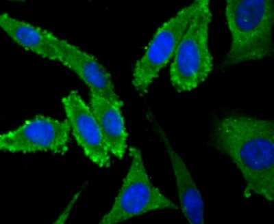 Immunocytochemistry/Immunofluorescence: Nav1.7 Antibody [NBP2-75581] - Staining NaV1.7 in SH-SY5Y cells (green). The nuclear counter stain is DAPI (blue). Cells were fixed in paraformaldehyde, permeabilised with 0.25% Triton X100/PBS.