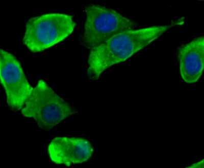 Immunocytochemistry/Immunofluorescence: Nav1.7 Antibody [NBP2-75582] - Staining NaV1.7 in A549 cells (green). The nuclear counter stain is DAPI (blue). Cells were fixed in paraformaldehyde, permeabilised with 0.25% Triton X100/PBS.