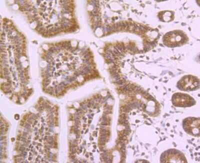 Immunohistochemistry-Paraffin: Nav1.7 Antibody [NBP2-75581] - Analysis of paraffin-embedded mouse colon tissue using anti-NaV1.7 beta antibody. Counter stained with hematoxylin.