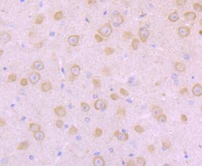 Immunohistochemistry-Paraffin: Nav1.8 Antibody [NBP2-75584] - Analysis of paraffin-embedded mouse brain tissue using anti-NaV1.8 antibody. Counter stained with hematoxylin.