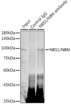 Immunoprecipitation: Nbs1 Antibody (4G4R1) [NBP3-16355] - Immunoprecipitation analysis of 300ug extracts of 293T cells using 3ug Nbs1 antibody (NBP3-16355). Western blot was performed from the immunoprecipitate using Nbs1 antibody (NBP3-16355) at a dilition of 1:1000.