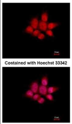 Immunocytochemistry/Immunofluorescence: Nck Antibody [NBP2-19489] - Immunofluorescence analysis of paraformaldehyde-fixed A431, using antibody at 1:500 dilution.