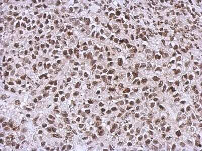 Immunohistochemistry-Paraffin: Nck Antibody [NBP2-19489] - Immunohistochemical analysis of paraffin-embedded Hela xenograft, using antibody at 1:500 dilution.