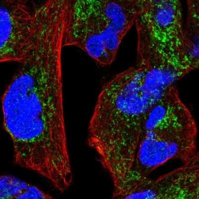 Immunocytochemistry/Immunofluorescence: Ndufs1 Antibody [NBP2-56504] - Staining of human cell line RH-30 shows localization to mitochondria.