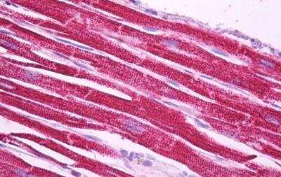 Immunohistochemistry-Paraffin: Ndufs1 Antibody [NBP1-52060] - Staining of paraffin embedded Human Heart. Antibody at 5 ug/mL. Steamed antigen retrieval with citrate buffer pH 6, AP-staining.